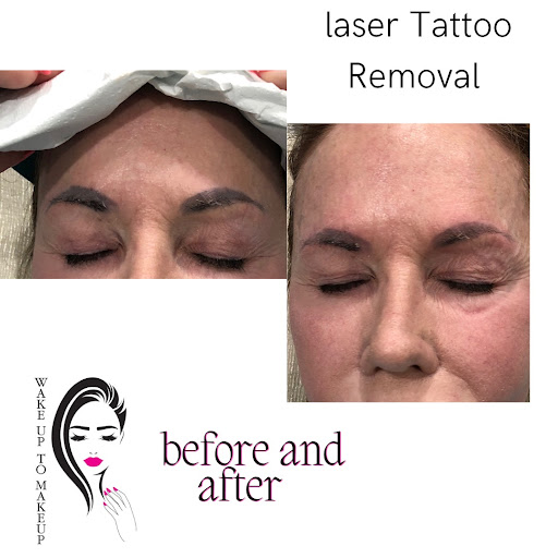 Explore crest tattoo ideas, creative tattoo ideas in Naples, available at Laser Tattoo Removal Services