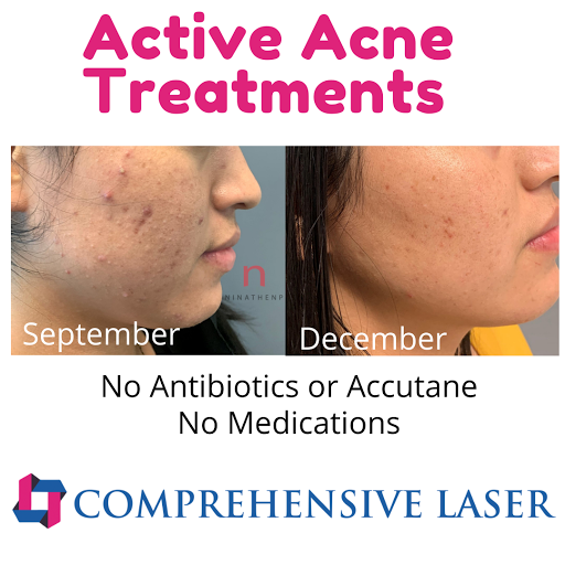 Find wild west tattoo ideas for your next unique tattoo in Columbia at Comprehensive Laser & Aesthetics