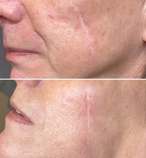 Explore small witch tattoo ideas, creative tattoo ideas in Santa Cruz, available at Luca Permanent Cosmetics