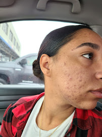 Nova Lush Aesthetics - Photo 8 - Car repair in Stamford, CT, Stamford