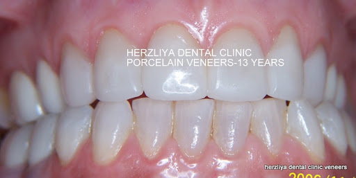 Dr. Farryl Jacobson - Herzliya Dental Clinic