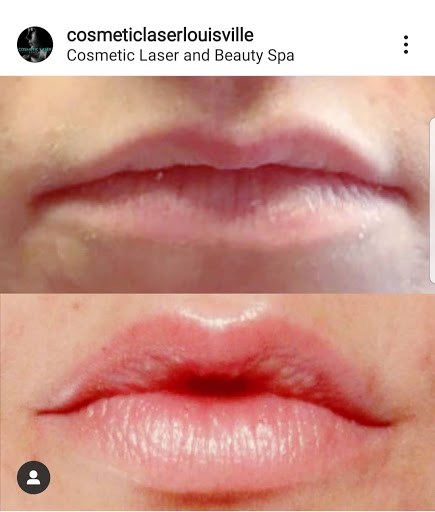 Hair Removal Service «Cosmetic Laser and Beauty Spa», reviews and photos, 3026 Eastpoint Pkwy, Louisville, KY 40223, USA