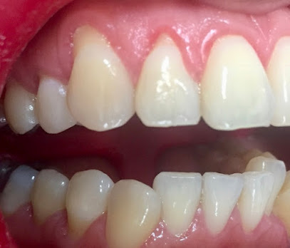 Implantes dentales y Periodoncia Dr. Frank Peinado