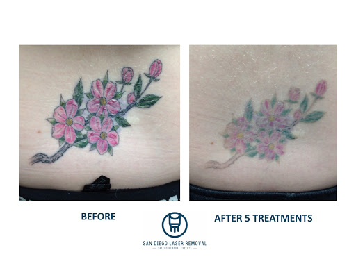 Explore tattoo ideas for self love, creative tattoo ideas in San Diego, available at Removery Tattoo Removal & Fading