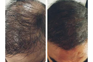 Growth & Glow (Hair Transplant Center & Skin Aesthetic Laser Center in Nandurbar) image