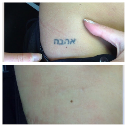 Explore unique tattoo ideas men, creative tattoo ideas in Lawrence, available at Removery Tattoo Removal & Fading