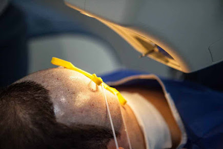 عيادة زراعة الشعر في باريس - Clinic of Hair Transplant in Paris