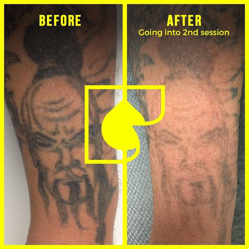 Explore new beginnings tattoo ideas, creative tattoo ideas in South Gate, available at Tattoo Removal Inc