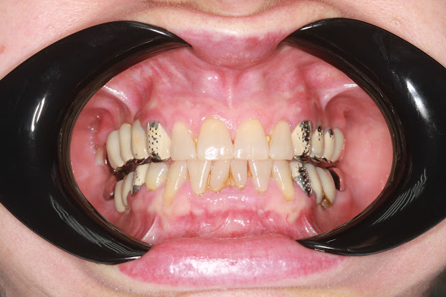 Smile Care - Dentist