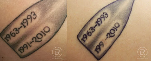 Explore thigh tattoo ideas, creative tattoo ideas in Minneapolis, available at Renewal Laser Clinic