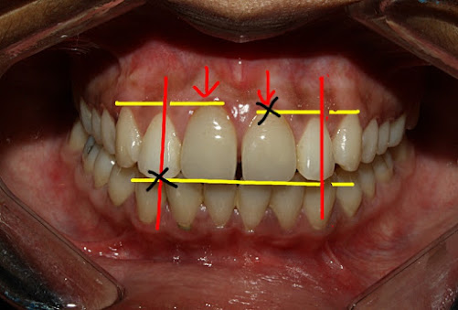 Malik dental clinic and implant center - Malik dental clinic and implant center