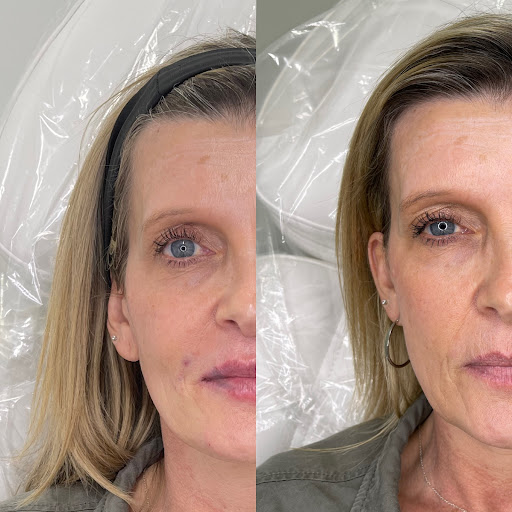 Explore cool cover up tattoo ideas, creative tattoo ideas in Owensboro, available at The Skin Lab