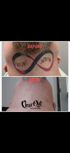 Explore rising sun tattoo ideas, creative tattoo ideas in Cookeville, available at Clear Out Ink Laser Tattoo Removal