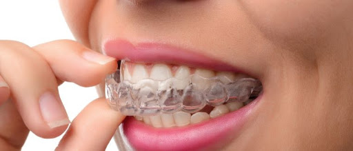 Smile Shine Dental Practice of Dr Sidhu - Roseville