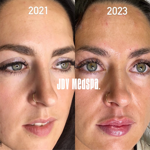 Explore skydive tattoo ideas, creative tattoo ideas in Canton, available at JDV Med Spa