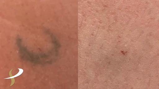 Explore good small tattoo ideas for guys, creative tattoo ideas in Spokane, available at Premier Body and Laser