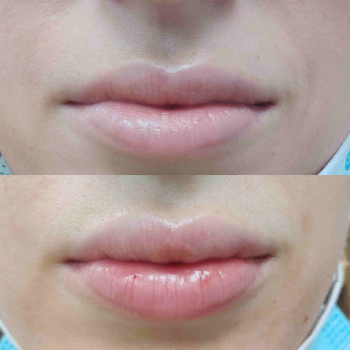 الدكتور كيتسيوس كريستوس - Dr Kitsios Christos