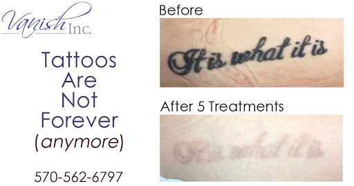 Explore female dragon tattoo ideas, creative tattoo ideas in Williamsport, available at Vanish Laser & Skin, Inc.