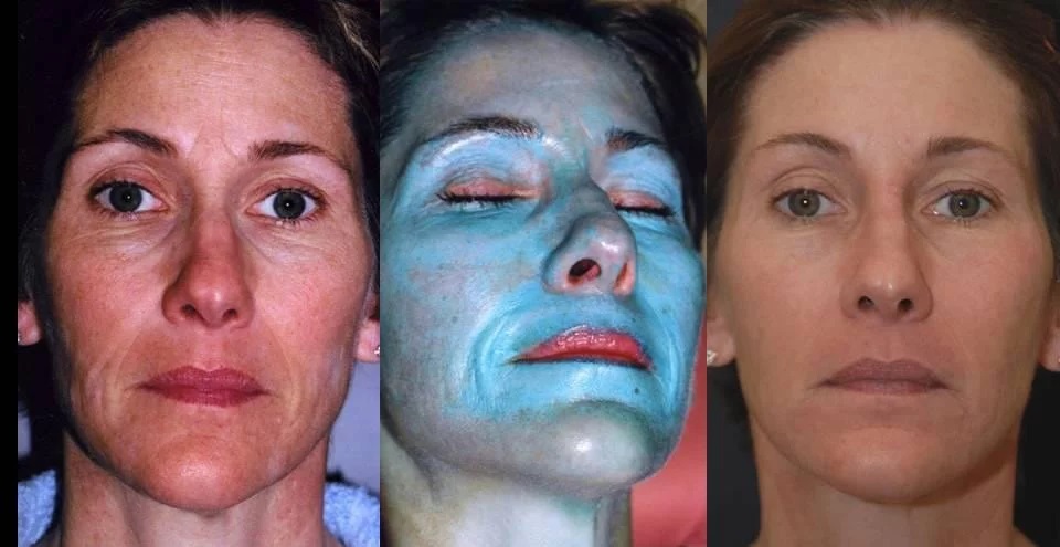 DermaScience Skin Clinic 32174