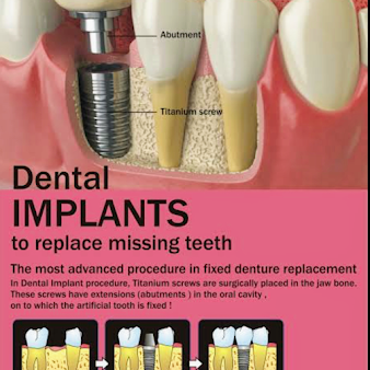 Teeth & Braces: Super Speciality Dental Care - Teeth & Braces: Super Speciality Dental Care