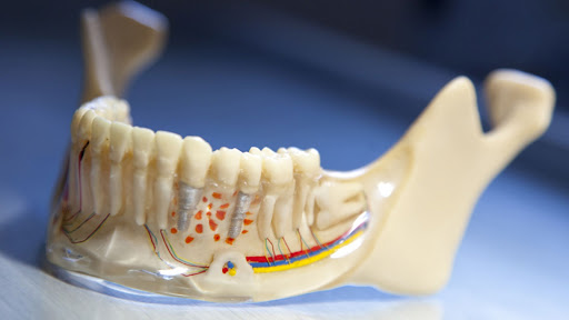 Dental Implants Albany image 1