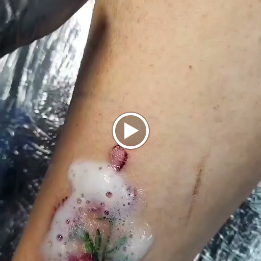 Explore scar cover up tattoo ideas, creative tattoo ideas in Rio Grande City, available at RG INK