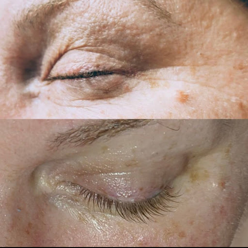 Explore dragonfly tattoo ideas for females, creative tattoo ideas in Oxford, available at Bare Facts Skin Aesthetics-Facials-Peels-Collagen Induced Therapy-Needling- Electrolysis-Ear Lobe & Helix Piercing.