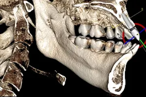 Melbourne Dental X-Ray image