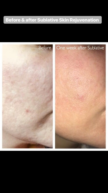 Parfaire Aesthetic Clinic - Parfaire Aesthetic Clinic