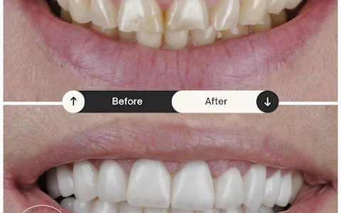Özel DentaPoint Diş Polikliniği Karşıyaka Şubesi Zirkonyum , Diş İmplantı , Estetik Diş Tedavileri , Ortodonti image