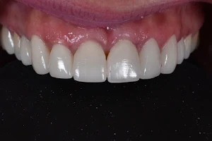 Miracle Smile Dentistry - Dr. Anna Aller image