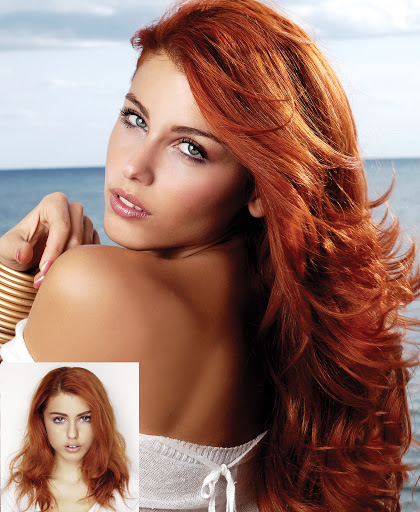 Hair Replacement Service «Elite Solutions Hair Loss Specialists of Sacramento», reviews and photos, 9294 Madison Ave, Orangevale, CA 95662, USA