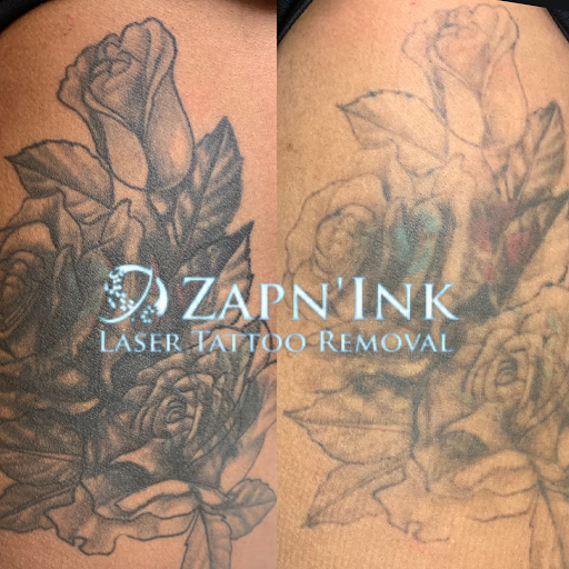 Explore tattoo ideas water, creative tattoo ideas in Beaumont, available at ZapnInk Laser Tattoo Removal