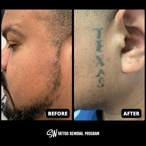 Explore tattoo ideas meaningful, creative tattoo ideas in San Antonio, available at South West Tattoo Removal Program