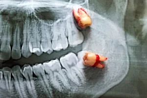 Manuel Dental Clinic-The Teeth Expert image