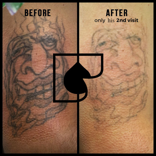 Explore celestial tattoo ideas, creative tattoo ideas in South Gate, available at Tattoo Removal Inc
