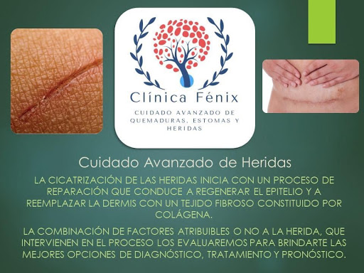 Clínica Fénix Cuidado Avanzado de Quemaduras, Estomas y Heridas