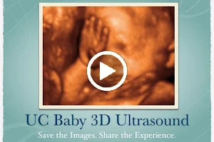 UC Baby 3D Ultrasound image