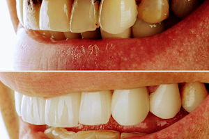 Implant Denture and Dental Center image