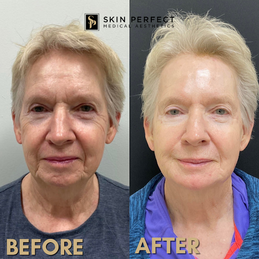 Explore 1 corinthians 13 tattoo ideas, creative tattoo ideas in Whittier, available at Skin Perfect Medical Aesthetics