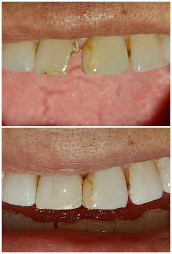 Dental 24/7 Emergencies - Dental 24/7 Emergencies