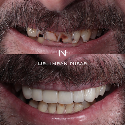 Dr. Imran Nisar - Manchester