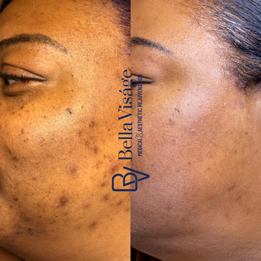 Explore broly tattoo ideas, creative tattoo ideas in Lakeland, available at Bella Visge Medical & Aesthetic Rejuvenation