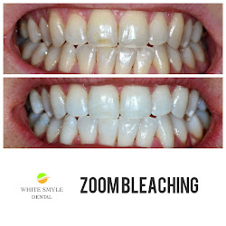 White Smyle - Zahnarzt, Zahnkorrektur, Implantate, Dentalhygiene & Bleaching