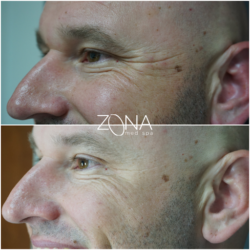 Skin Care Clinic «ZONA MED SPA», reviews and photos, 9767 N 91st St #102, Scottsdale, AZ 85258, USA