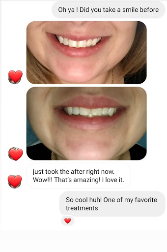 Explore cloud sleeve tattoo ideas, creative tattoo ideas in Chino, available at SoCal Body Institute