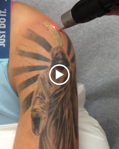 Explore tattoo ideas for dads with daughters, creative tattoo ideas in Lake Oswego, available at Lake Oswego Vein and Aesthetic LOVA