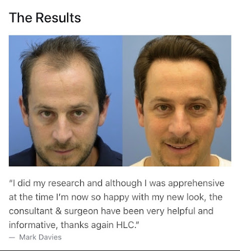 hairlosstreatmentclinics.co.uk