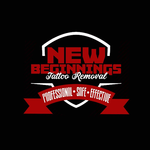 Explore black tattoo ideas, creative tattoo ideas in Arvada, available at New Beginnings Tattoo Removal