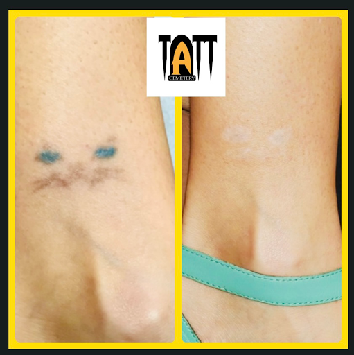 Explore mad max tattoo ideas, creative tattoo ideas in Fort Myers, available at Laser Tattoo Removal by Tatt Cemetery